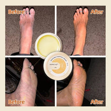 Load image into Gallery viewer, Winter Anti-Cracking Frost