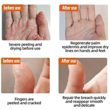 Load image into Gallery viewer, Winter Anti-Cracking Frost